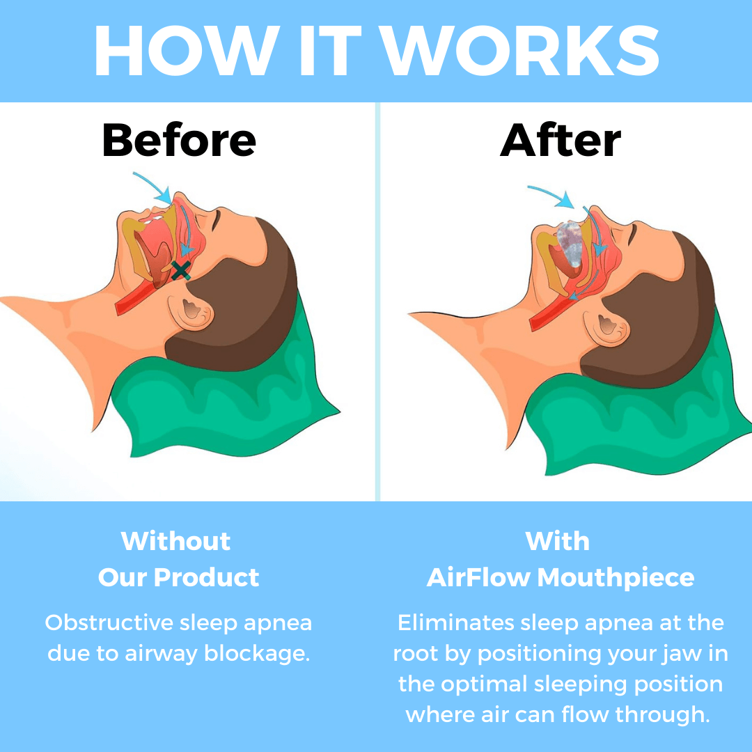 AirFlow Mouthpiece